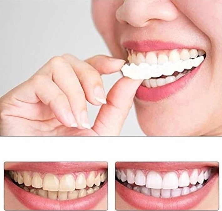 Snap On Teeth Veneers