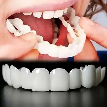Snap On Teeth Veneers